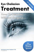Eye Chalazion: How To Remove Without Surgery: My personal experience and the methods I used for success - Paperback
