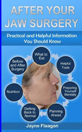 After Your Jaw Surgery: Practical and Helpful Information You Should Know - Paperback