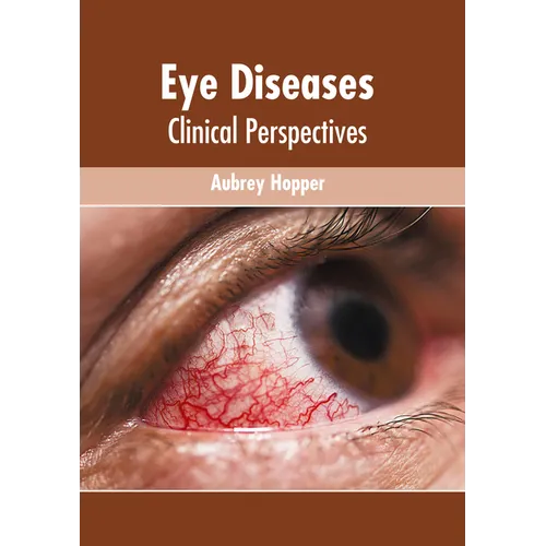 Eye Diseases: Clinical Perspectives - Hardcover