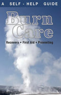 Burn Care: Recover, First Aid, Treatment - Paperback