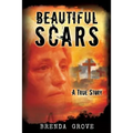 Beautiful Scars - Paperback