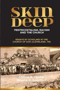 Skin Deep: Pentecostalism, Racism and the Church: - Paperback