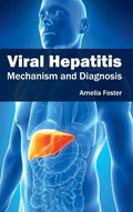 Viral Hepatitis: Mechanism and Diagnosis - Hardcover