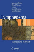 Lymphedema: Diagnosis and Treatment - Hardcover