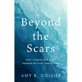 Beyond the Scars: How I Learned God Didn't Abandoned Me in My Darkest Hour - Paperback