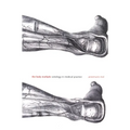 The Body Multiple: Ontology in Medical Practice - Paperback