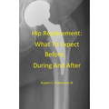 Hip Replacement: What To Expect Before, During and After - Paperback