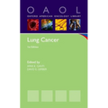 Lung Cancer - Paperback