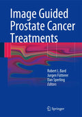 Image Guided Prostate Cancer Treatments - Hardcover