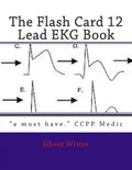 The Flash Card 12 Lead EKG - Paperback