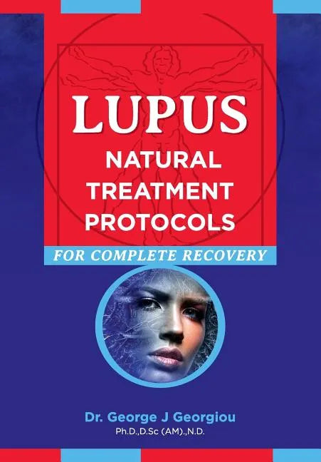 Lupus: Natural Treatment Protocols for Complete Recovery - Paperback
