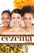 The Natural Eczema Solution: Simple Healing Guidelines for Beautiful Skin. - Paperback