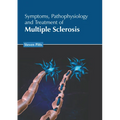 Symptoms, Pathophysiology and Treatment of Multiple Sclerosis - Hardcover
