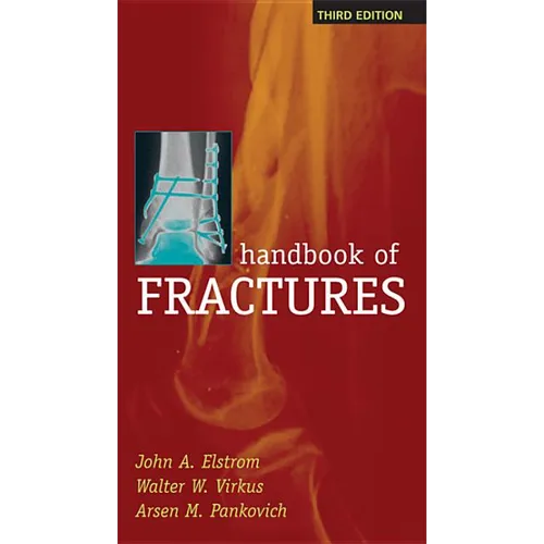 Handbook of Fractures, Third Edition - Paperback