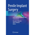 Penile Implant Surgery: Contemporary Challenges and Controversies - Paperback
