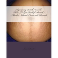 Agonizing stretch marks-How To Get Rid Of Stretch Marks: Natural Cures and Remedi - Paperback